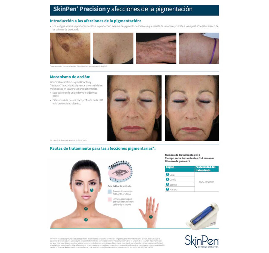 SkinPen Precision y Afecciones de la Pigmentación