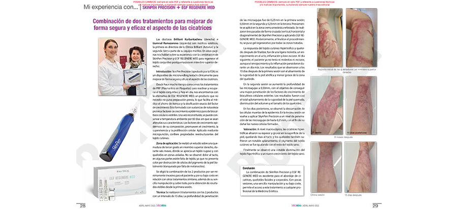 Combinación de dos tratamientos para mejorar de forma segura y eficaz el aspecto de las cicatrices
