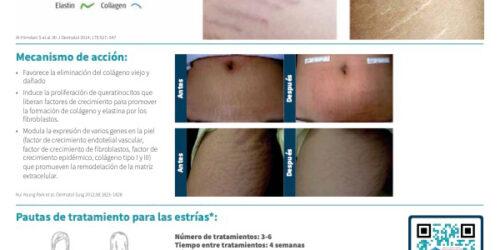 SkinPen Precision y Estrías