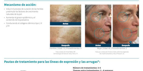 SkinPen Precision y Líneas Finas y Arrugas