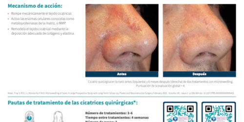 SkinPen Precision y Cicatrices Quirúrgicas