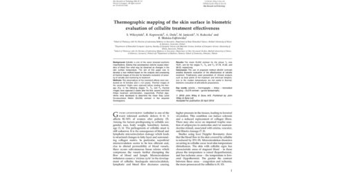 Thermographic mapping of the skin surface in biometric evaluation of cellulite treatment effectiveness - ALIDYA