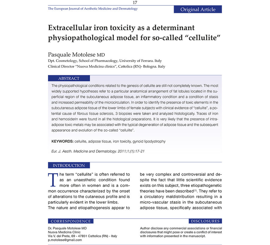 Extracellular iron toxicity as a determinant physiopathological model for so-called "cellulitie"