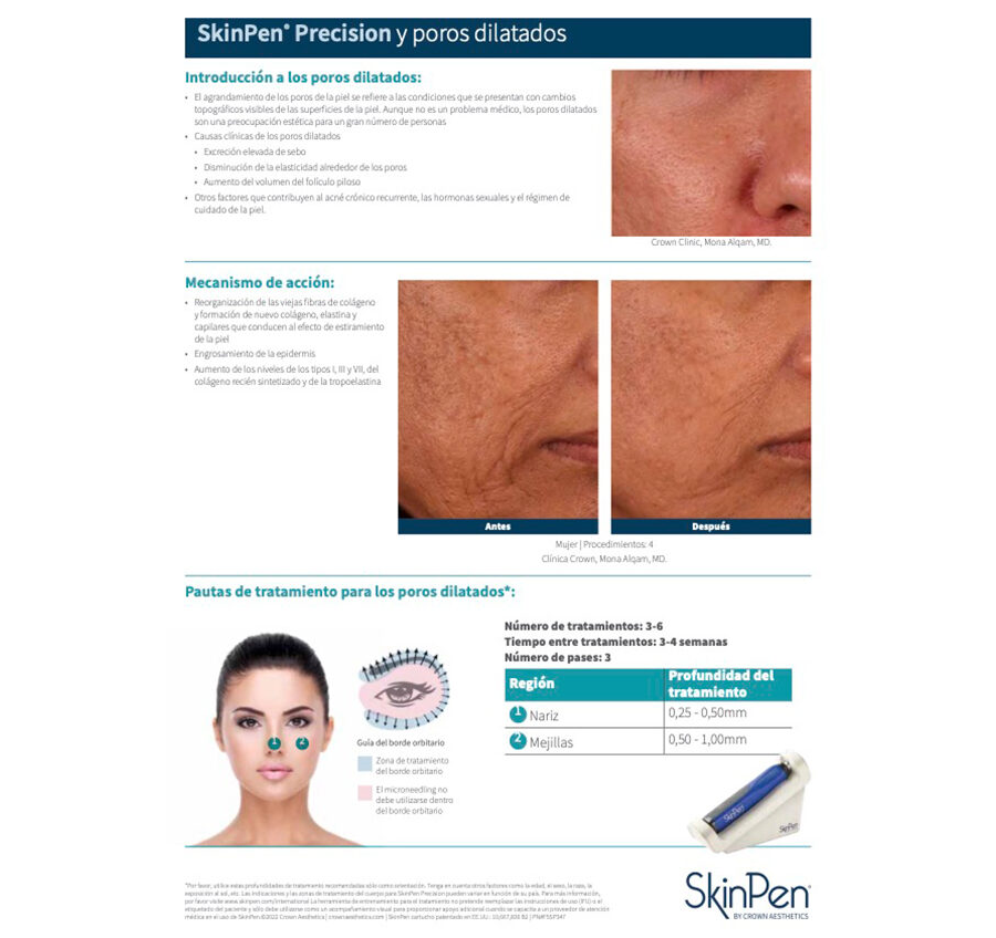 SkinPen Precision y Poros Dilatados
