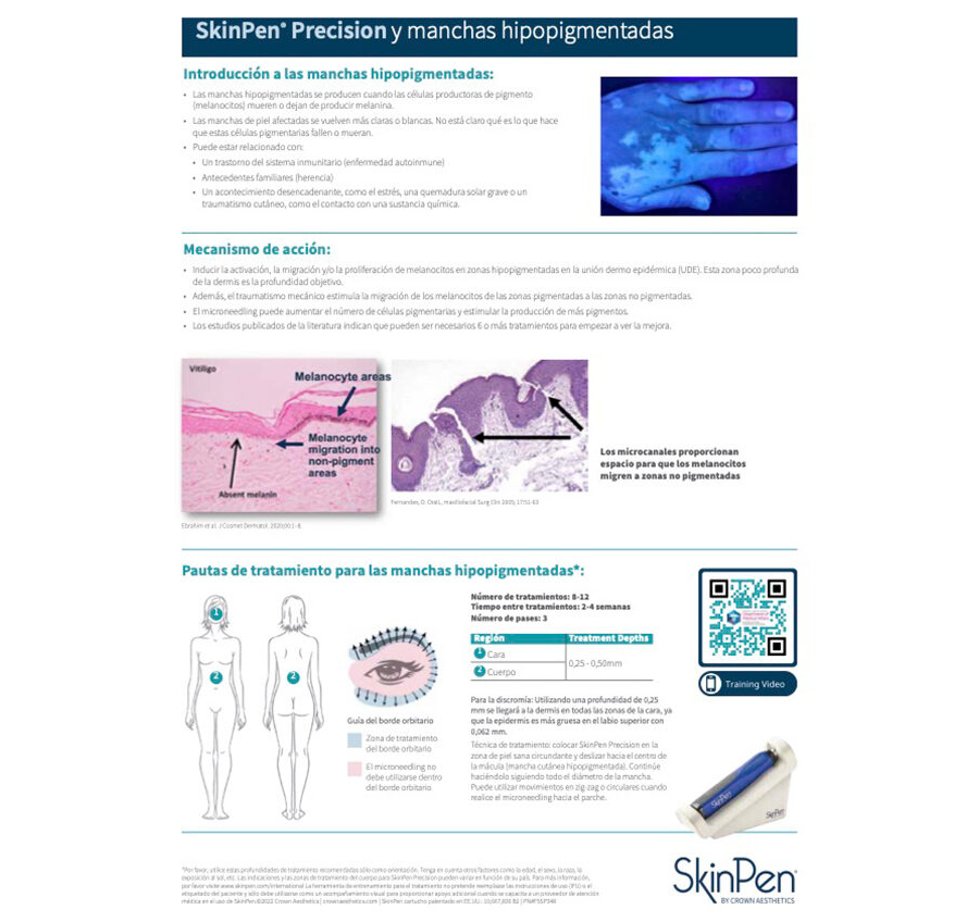 SkinPen Precision y Manchas Hipopigmentadas